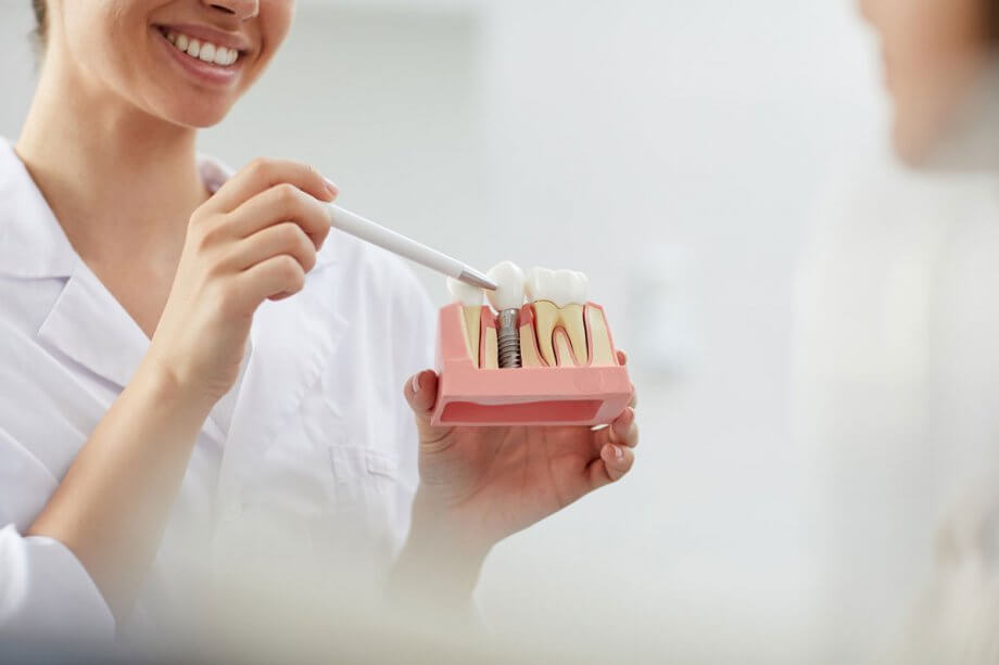 model of a dental implant