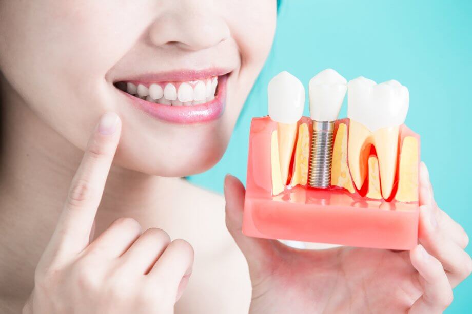 Female Patient Holding Up Dental Implant Model